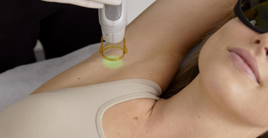 Ditch the Razor: Why Laser Hair Removal is the Best Choice for Underarms