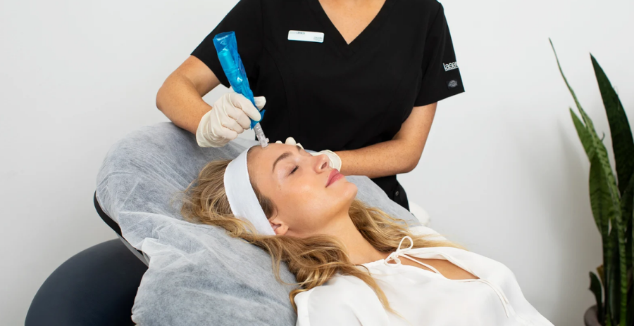 How Microneedling Works?