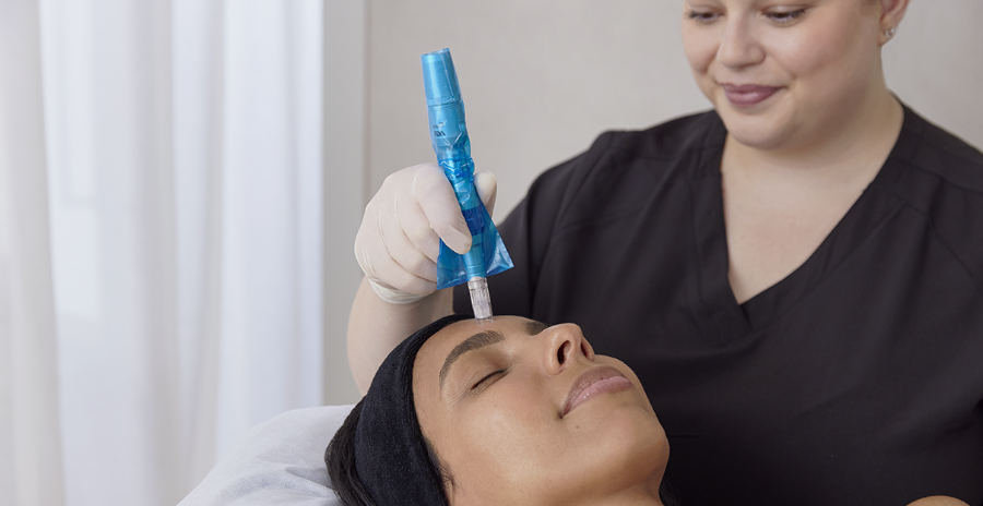 Differences Between At-Home And Professional Microneedling / Skin Needling
