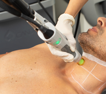 Mens Laser Hair Removal | Laser Clinics Australia