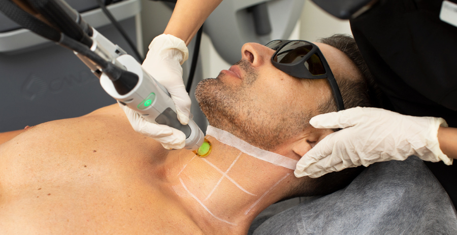 How Often Do I Need To Get Laser Hair Removal?