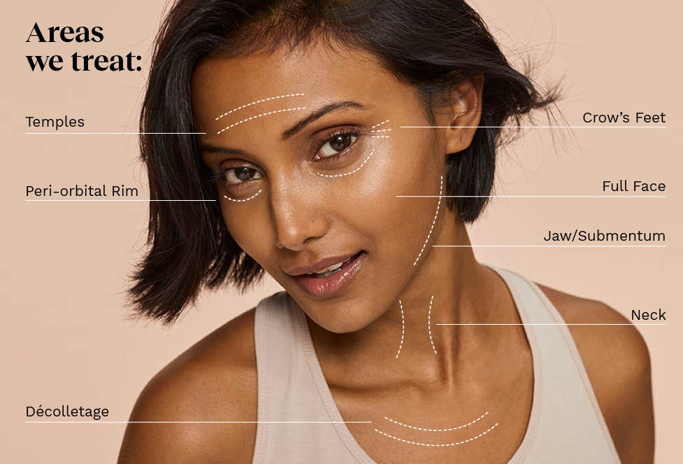 PRP Treatment Areas.jpg