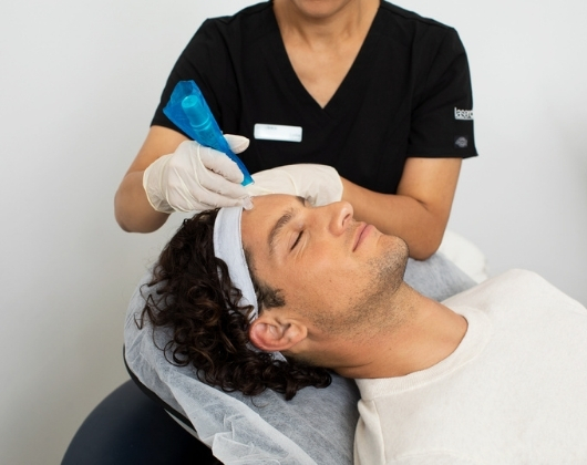 NEEDLING 530x420.jpg