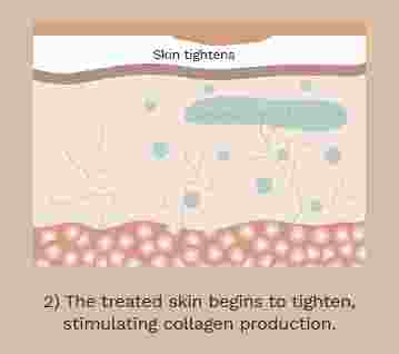 PDO threads_how it works_359 x 318px2 final 2.jpg