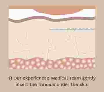 PDO Threads_how it works_359 x 318px final 1.jpg