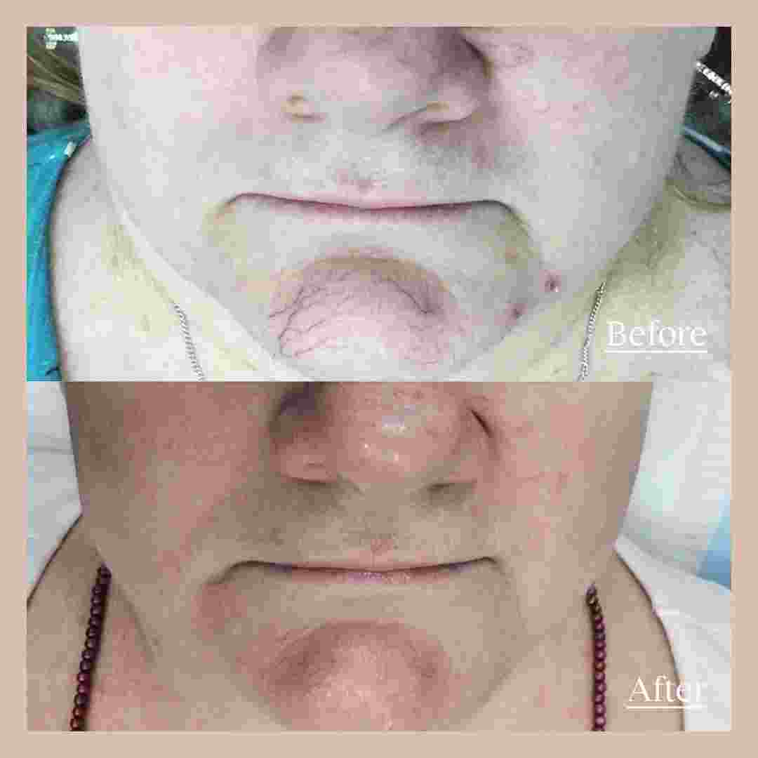 skin11.jpg