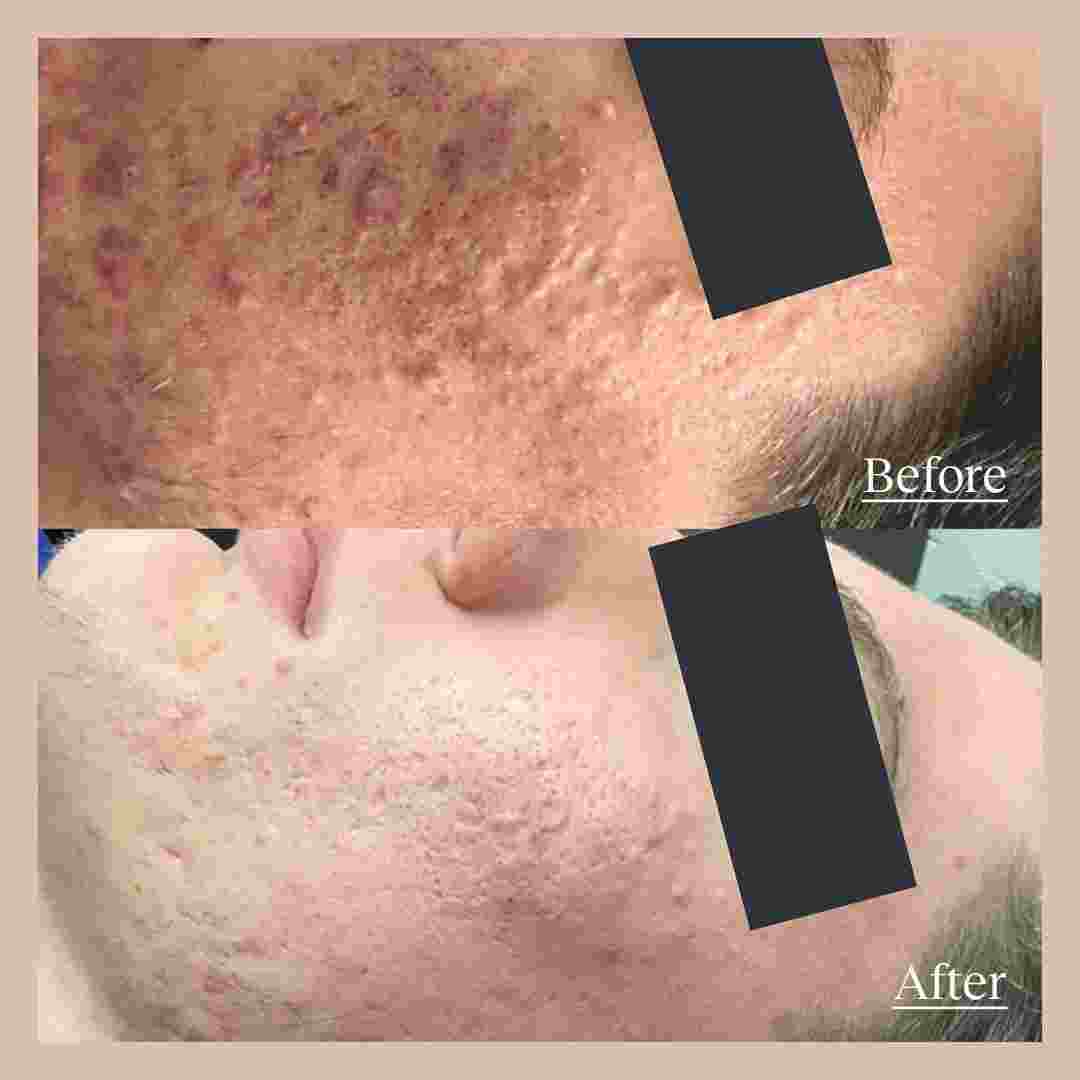 skin15kleresca.jpg