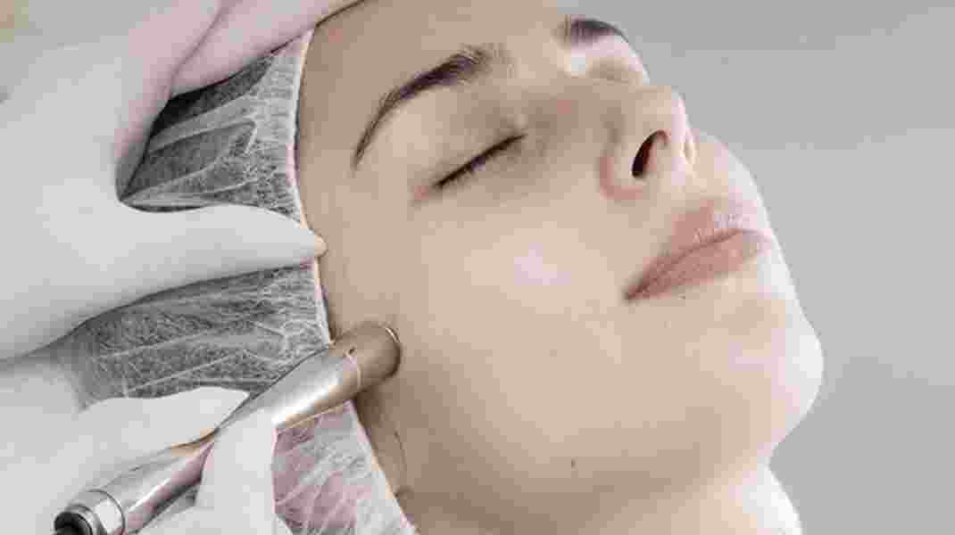 15 impressive facts about Microdermabrasion
