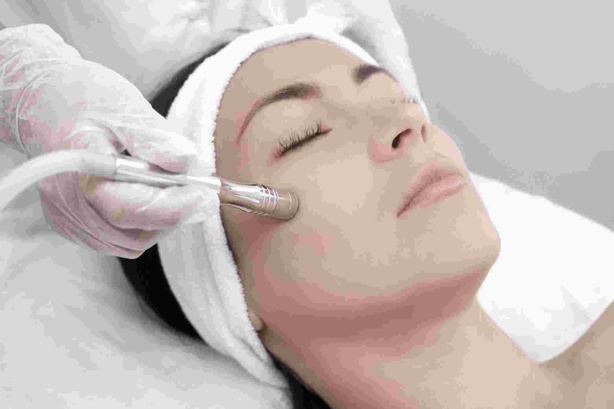 Everything you need to know about the 5-Step Microdermabrasion