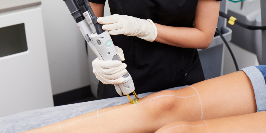 Why You Should Start Your Laser Hair Removal in Winter
