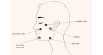 Profhilo Areas We Treat (1).png