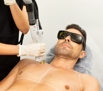 mens laser 359x318 (1).jpg