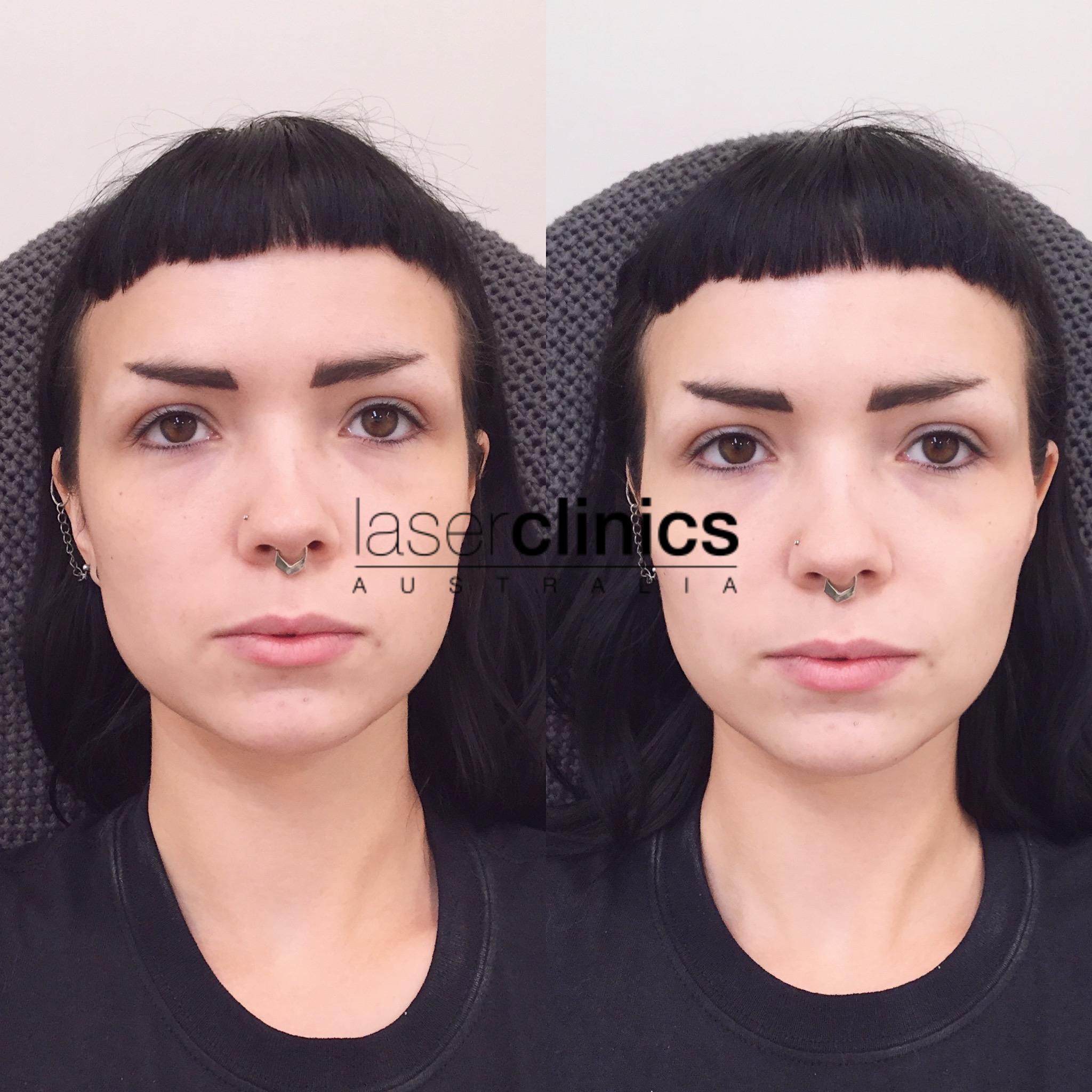 Toowong | Laser Clinics Australia Toowong | Laser Clinics Australia