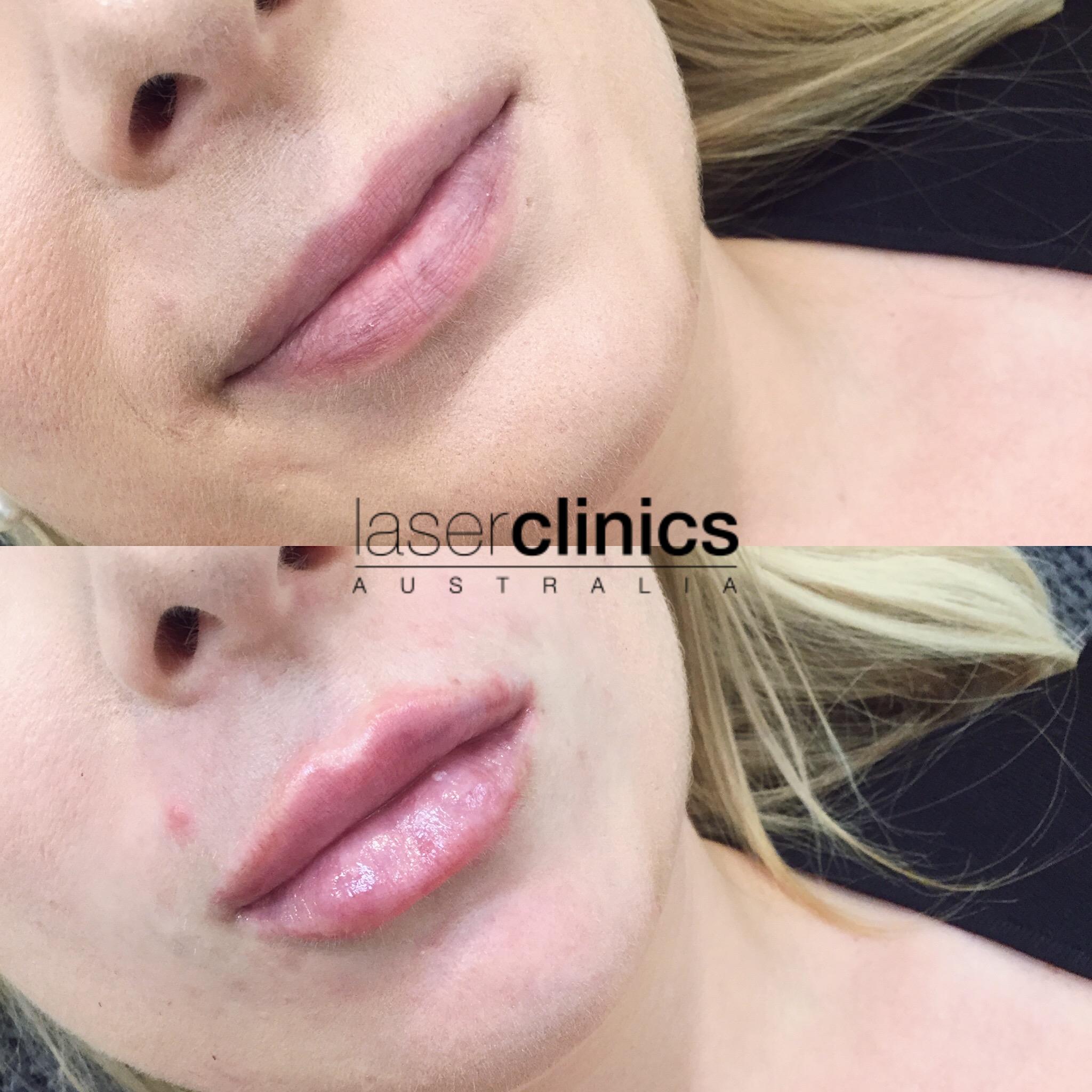 Toowong | Laser Clinics Australia Toowong | Laser Clinics Australia