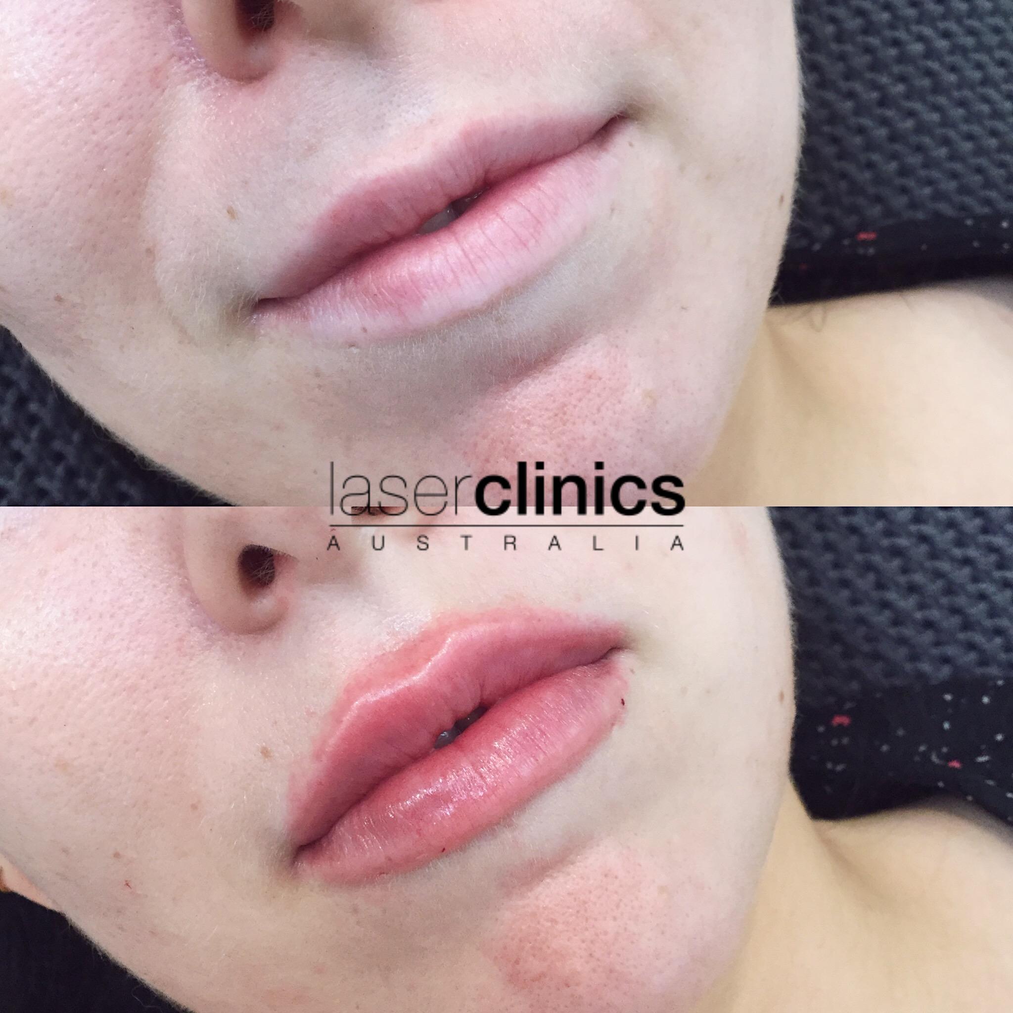 Toowong | Laser Clinics Australia Toowong | Laser Clinics Australia