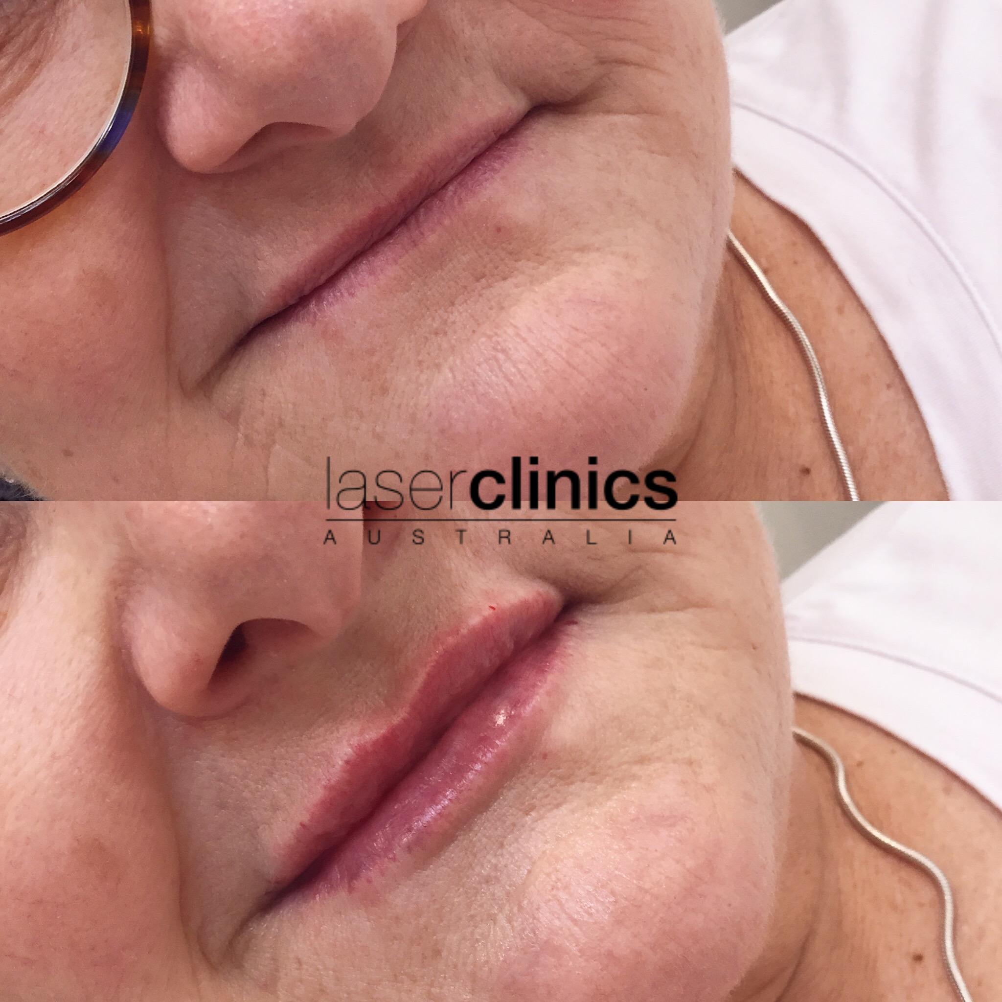 Toowong | Laser Clinics Australia Toowong | Laser Clinics Australia