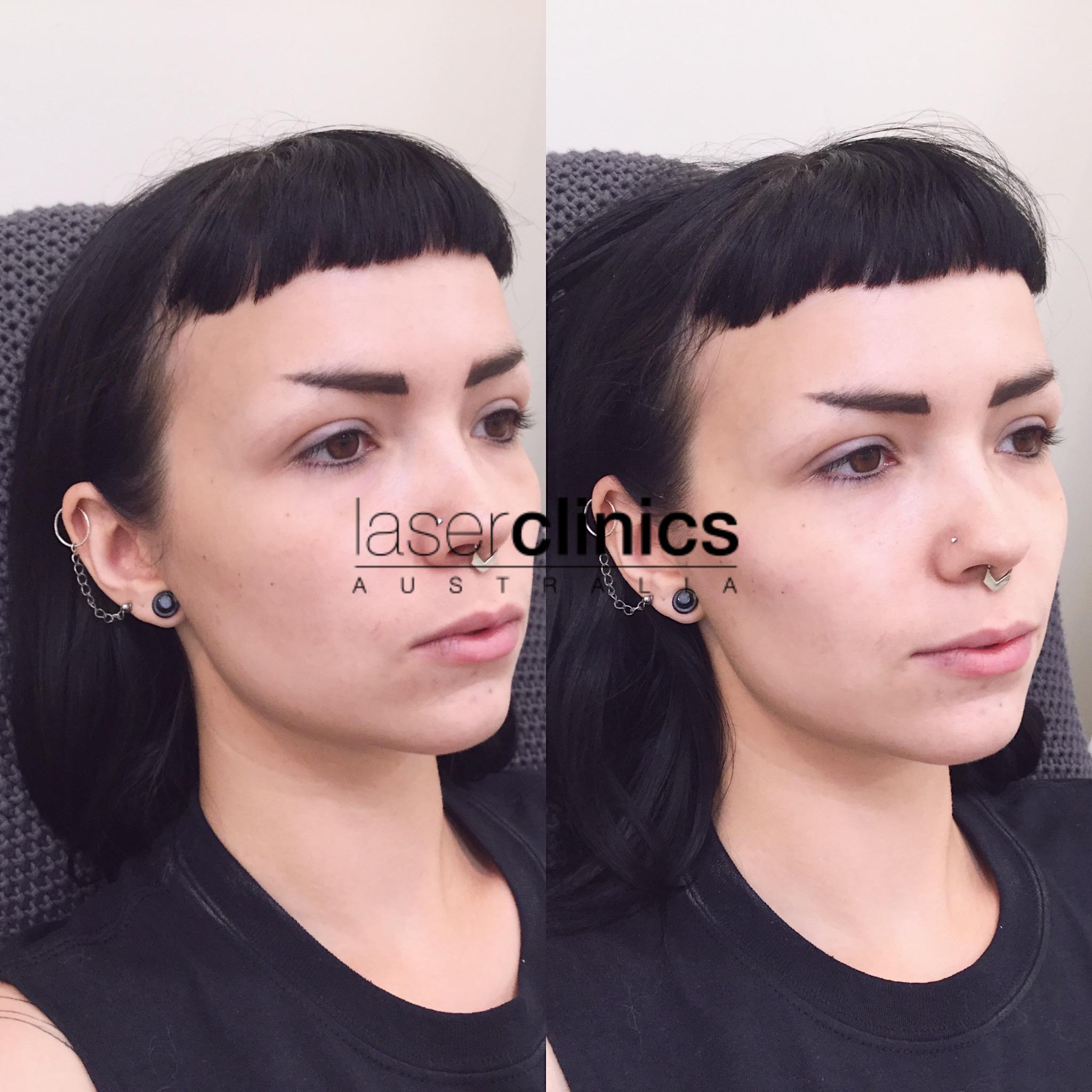 Toowong | Laser Clinics Australia Toowong | Laser Clinics Australia
