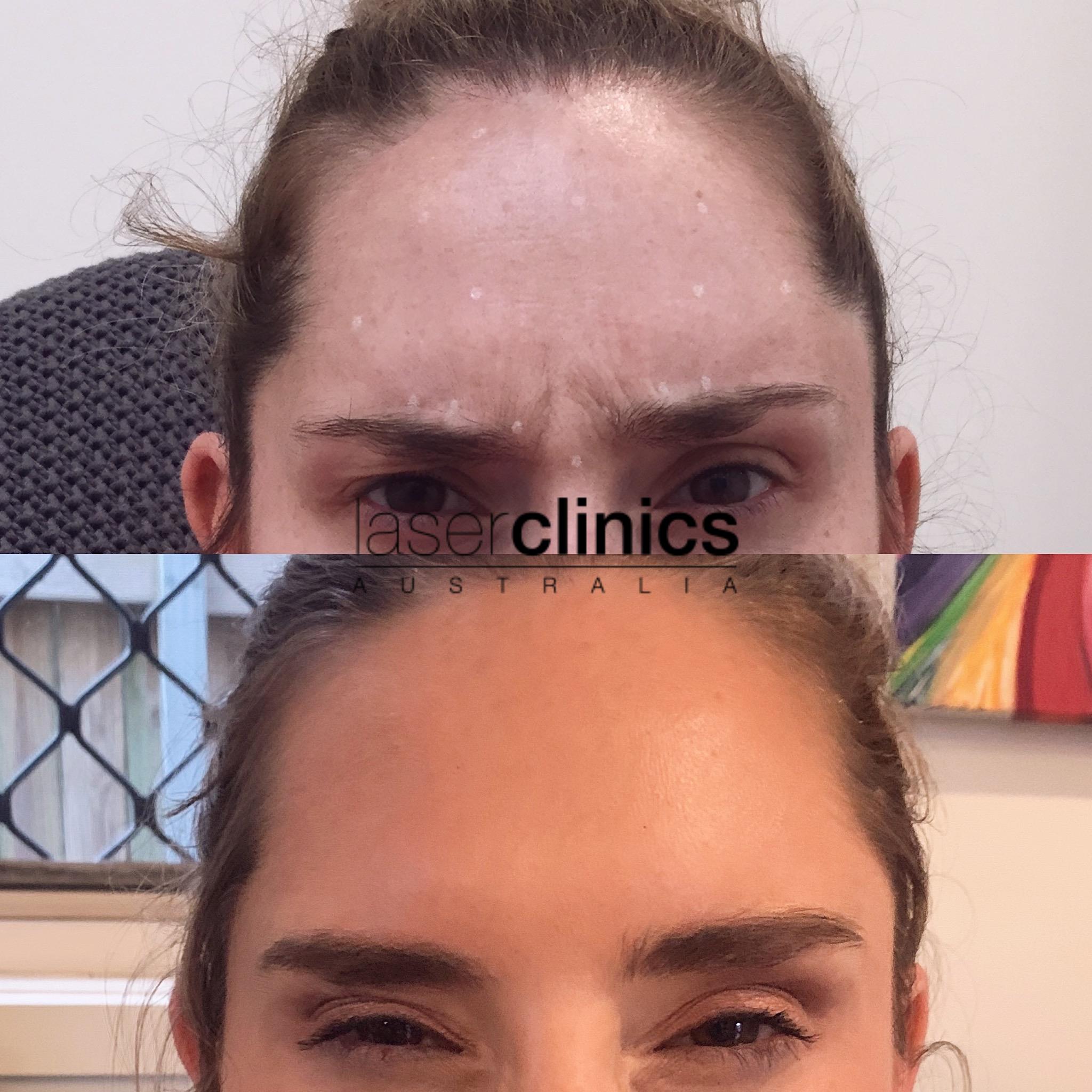 Toowong | Laser Clinics Australia Toowong | Laser Clinics Australia