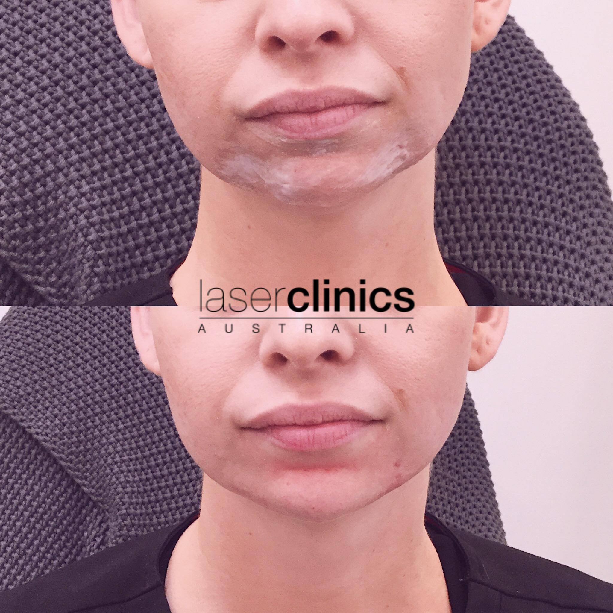 Toowong | Laser Clinics Australia Toowong | Laser Clinics Australia