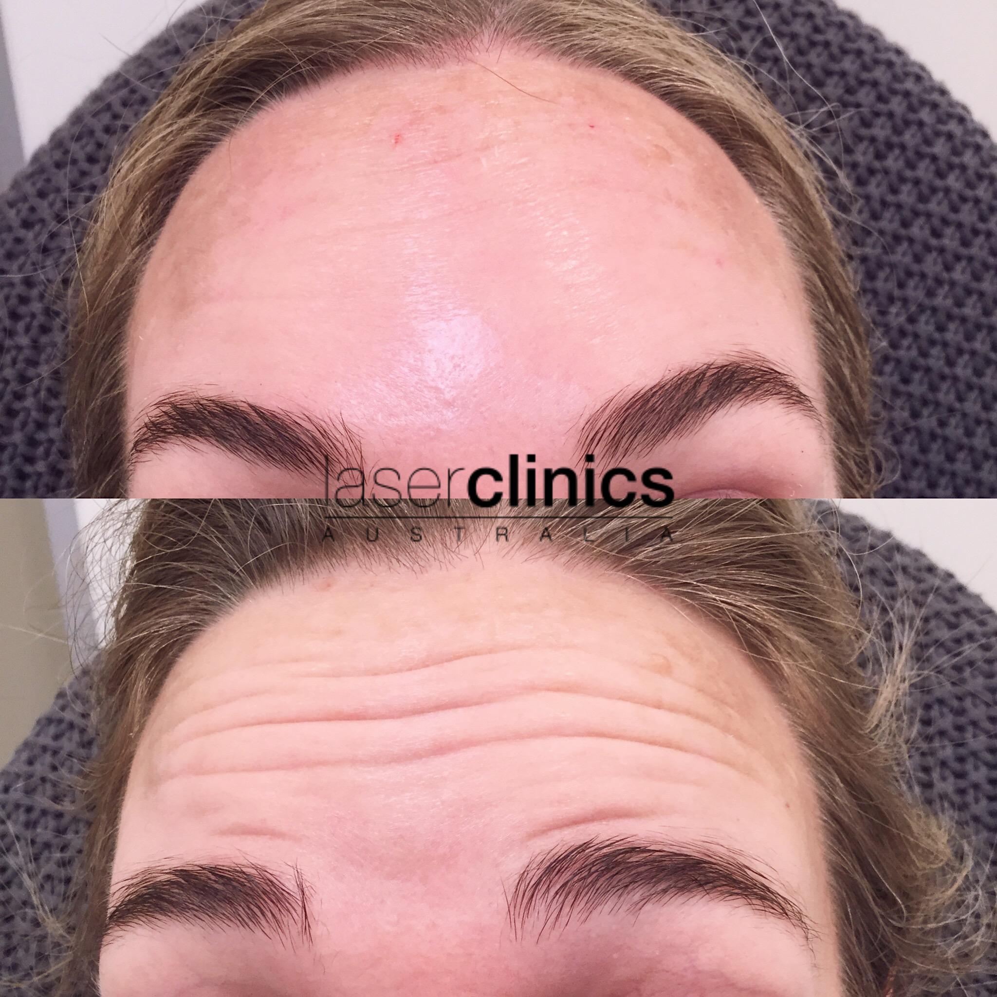 Toowong | Laser Clinics Australia Toowong | Laser Clinics Australia