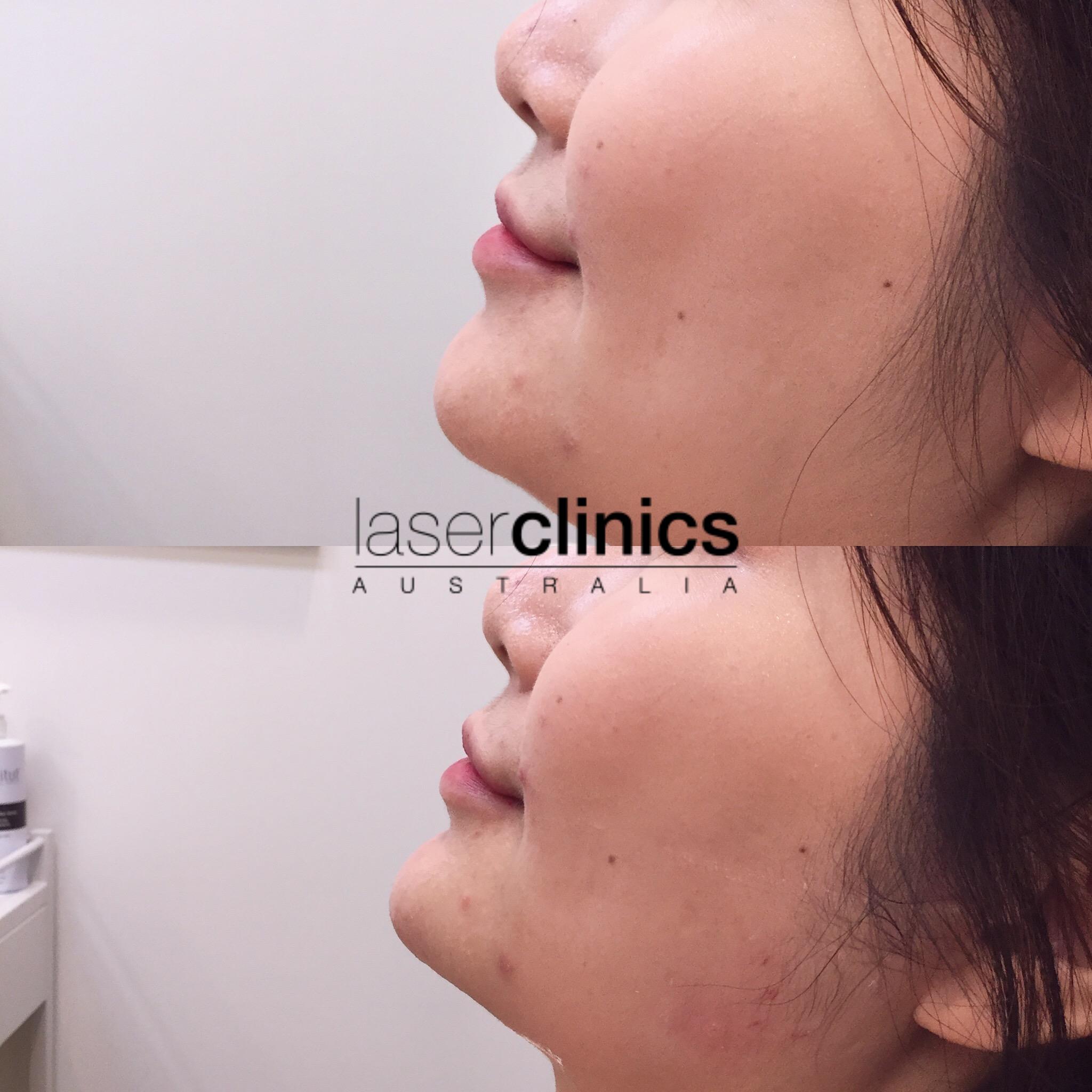 Toowong | Laser Clinics Australia Toowong | Laser Clinics Australia