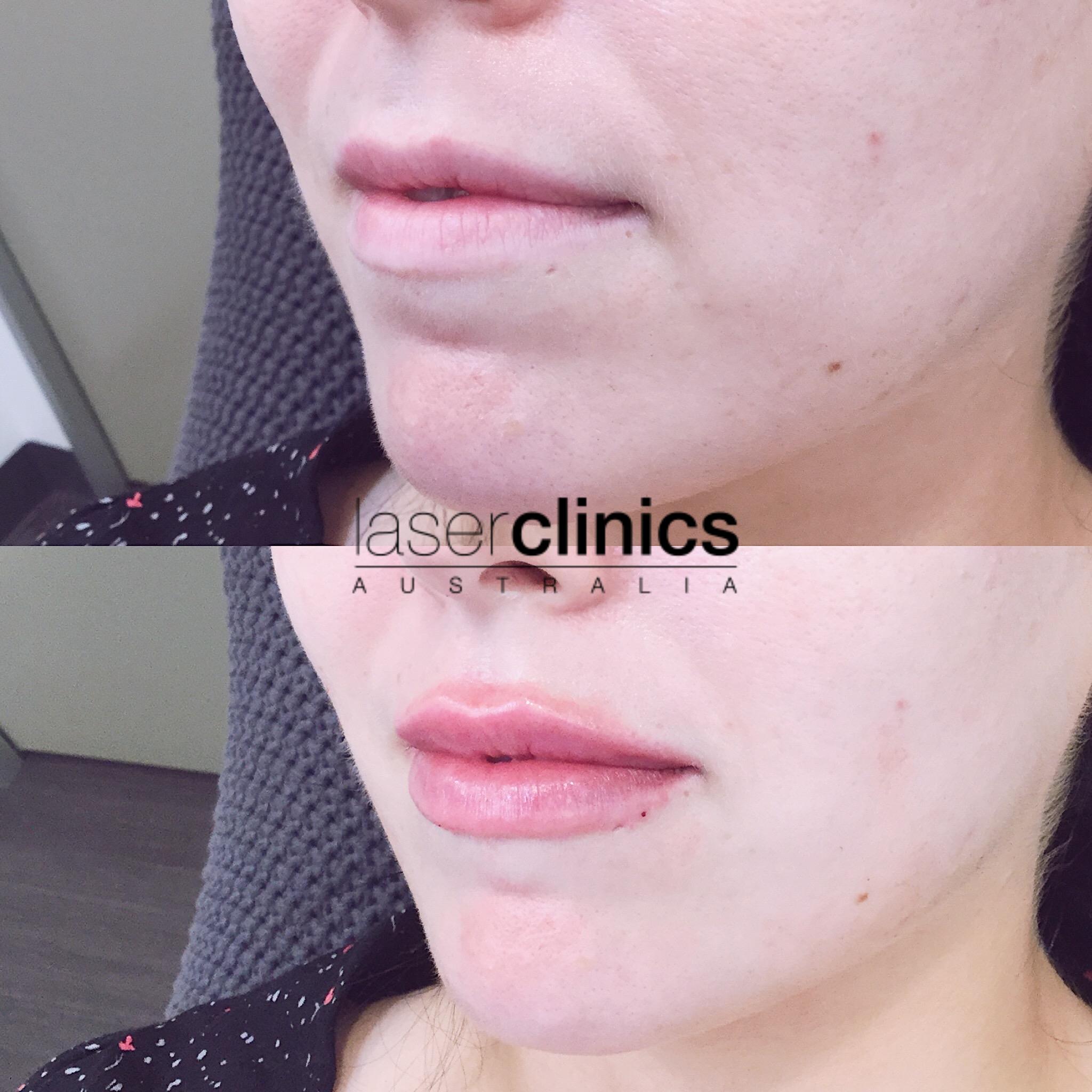 Toowong | Laser Clinics Australia Toowong | Laser Clinics Australia