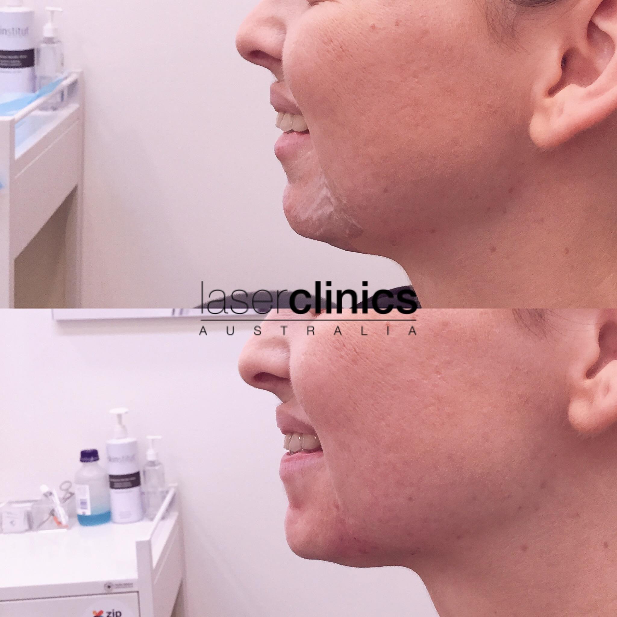 Toowong | Laser Clinics Australia Toowong | Laser Clinics Australia