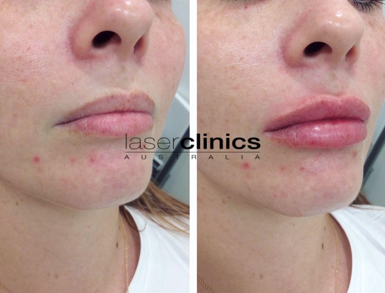 Toowong | Laser Clinics Australia Toowong | Laser Clinics Australia