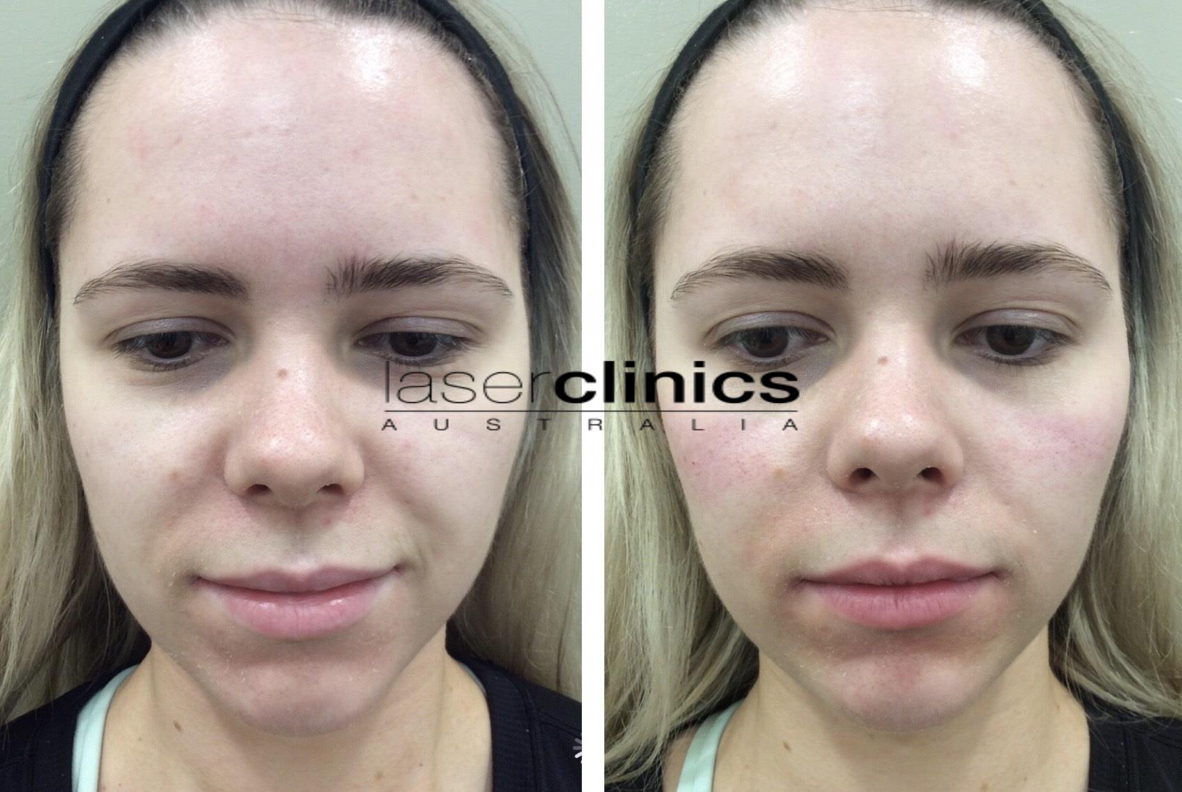 Toowong | Laser Clinics Australia Toowong | Laser Clinics Australia