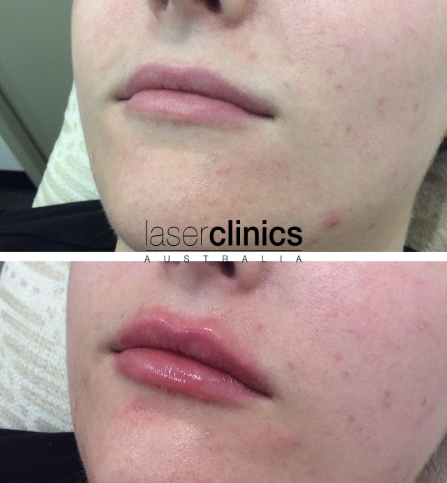 Toowong | Laser Clinics Australia Toowong | Laser Clinics Australia
