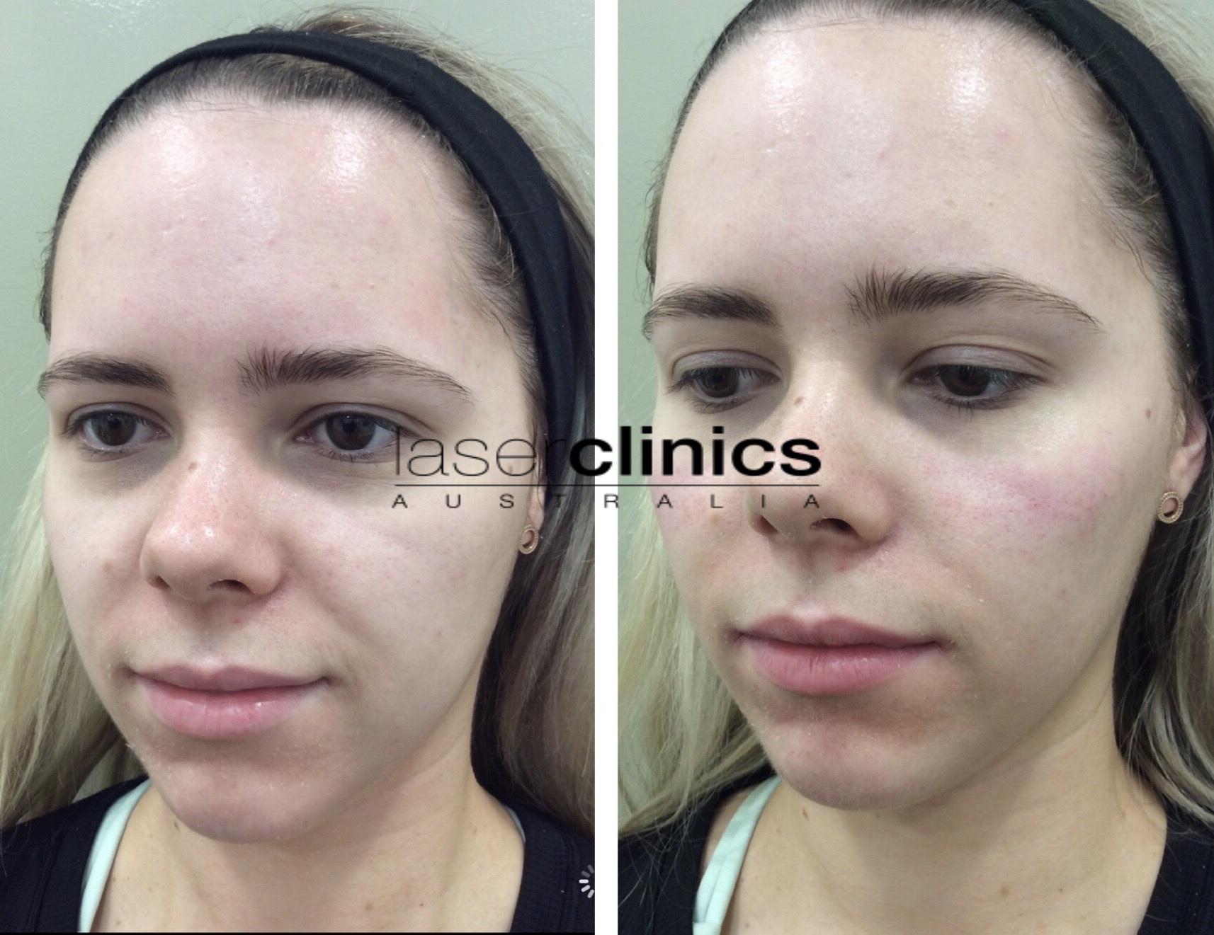 Toowong | Laser Clinics Australia Toowong | Laser Clinics Australia