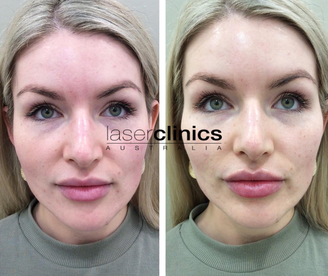 Toowong | Laser Clinics Australia Toowong | Laser Clinics Australia