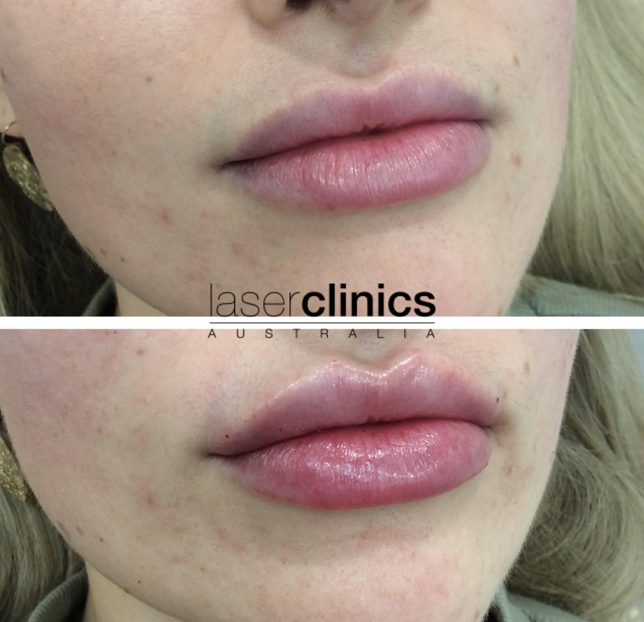 Toowong | Laser Clinics Australia Toowong | Laser Clinics Australia